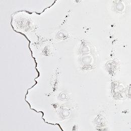 The Ordinary Skin Recovery: The Final Step of Your Workout.